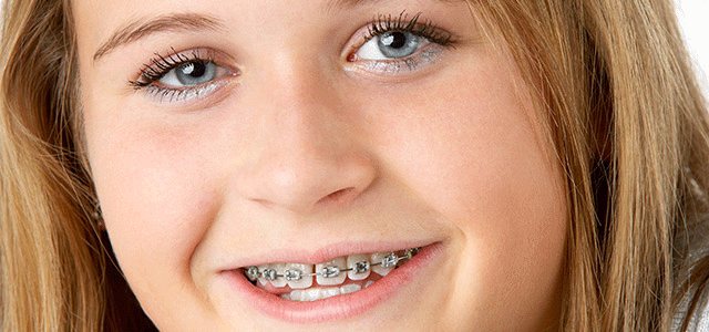 How Soon Should Your Pre-Teen See the Orthodontist?