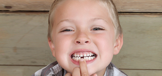 My Child is Missing a Tooth. What are Our Options?