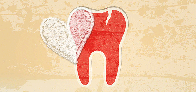 The Link between Gum Disease and Your Heart: Fact or Fiction?